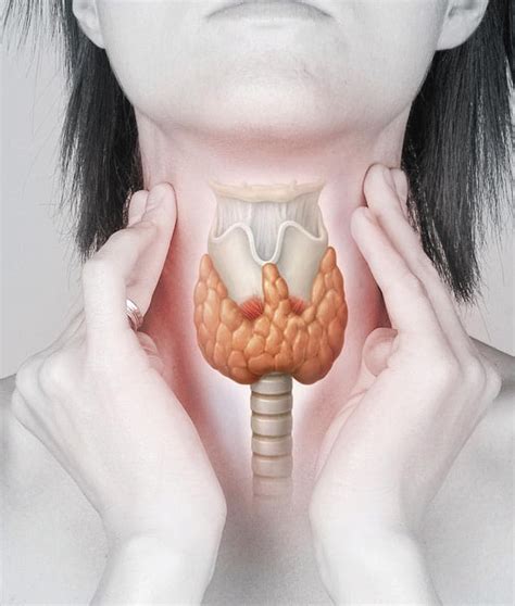 Cáncer de tiroides: ¿qué es? Causas, síntomas, etapas y ...