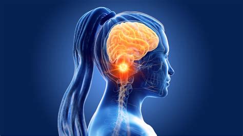 Cáncer del sistema nervioso central: causas, síntomas y ...