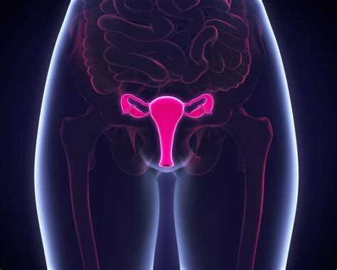 Cáncer en útero: síntomas, por qué se produce y ...