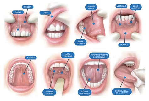 Cáncer Oral Archives   Cuidado Dental PersonalizadoCuidado ...