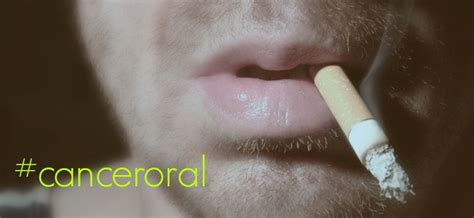 Cáncer oral, causas, síntomas y tratamientos