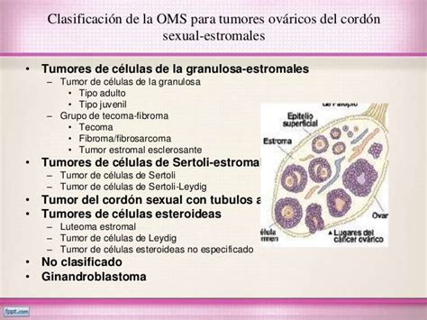 Cancer y tumores de ovario