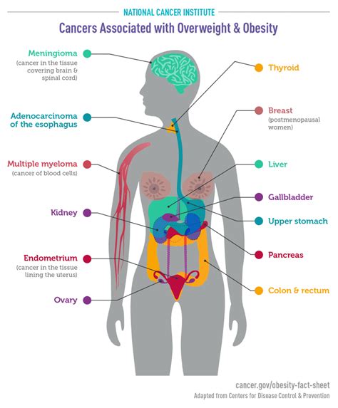 Cancers Associated with Overweight and Obesity Infographic ...