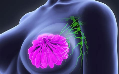 Cancro al seno, scoperti geni che possono predire il rischio