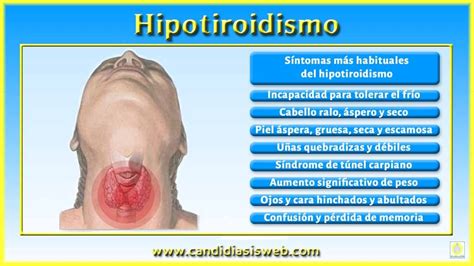 CandidiasisWeb — El hipotiroidismo se caracteriza por la...