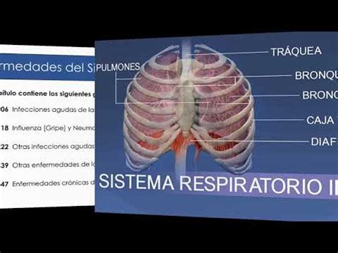 Capítulo X Enfermedades del Sistema Respiratorio   YouTube