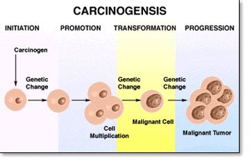 Carcinogenesis   Colon Cancer
