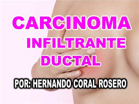 CARCINOMA INFILTRANTE DUCTAL   CÁNCER DE MAMA   YouTube