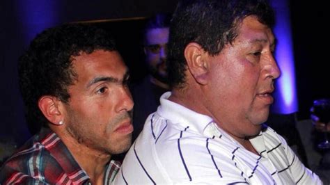 Carlos Tevez: la historia de la cicatriz que lleva en el ...