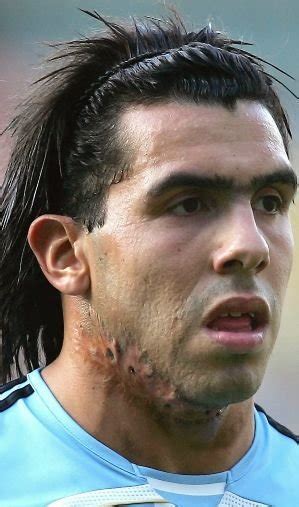 Carlos Tevez s Neck. Home | Facebook