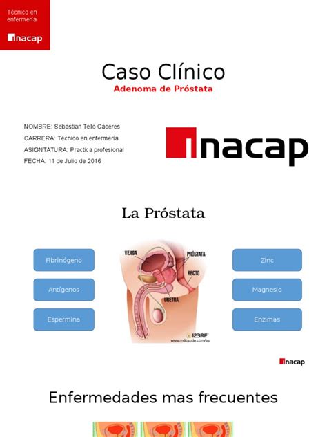 Caso Clínico prostata | Cancer de prostata | Vejiga urinaria