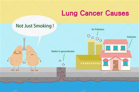 causas de cáncer de pulmón — Vector de stock ...