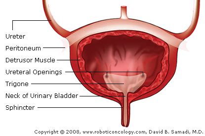 Causes and Symptoms of Bladder Cancer   Robotic Oncology