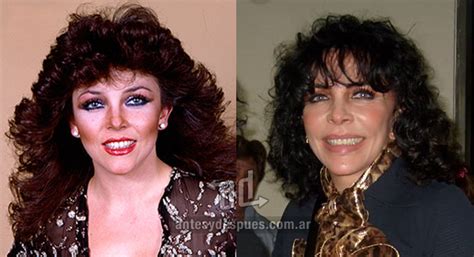 » Celebrities with Plastic Surgery | Before and After ...