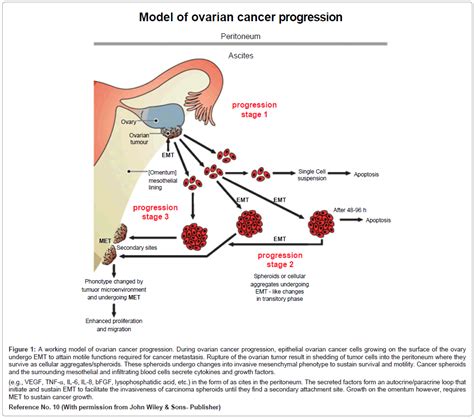cell science therapy ovarian cancer