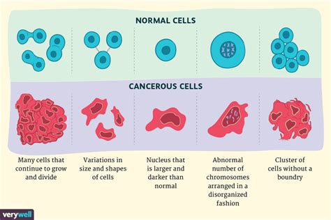 Células cancerosas vs. células normales: ¿cómo son diferentes ...