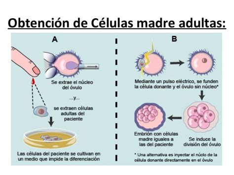 Celulas madre