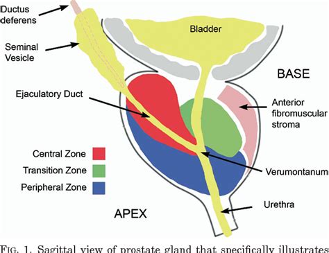 Central Zone Prostate Mri : Prostate sector map. AS = anterior ...