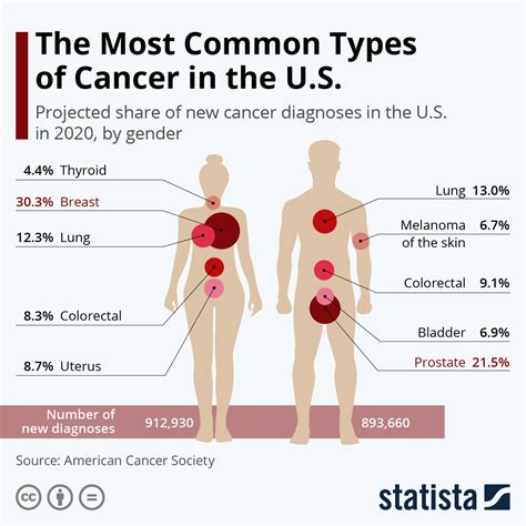 Chart: The Most Common Types of Cancer in the U.S. | Statista