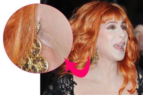 Cher Plastic Surgery Procedures: Details and Before After ...