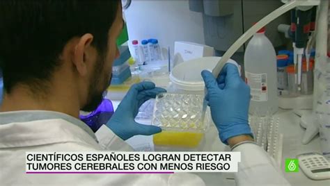 Científicos españoles logran detectar el tumor cerebral mediante una ...