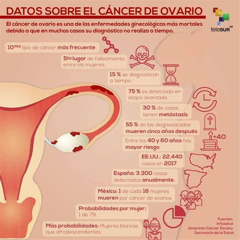Cifras del cáncer de ovario | Multimedia | teleSUR