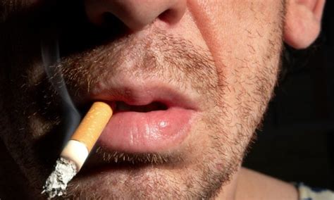 Cigarro é o principal responsável pelo câncer de boca   ViDA & Ação