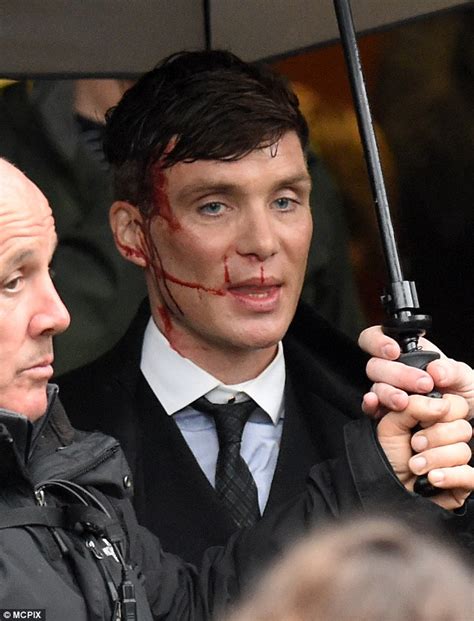 Cillian Murphy sports nasty facial  injury  on the set of ...