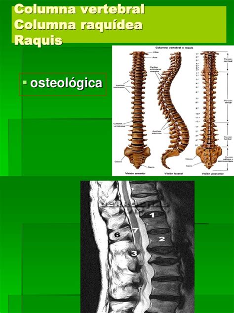 Clase 3 Anatomia Columna Osteologia | Columna vertebral ...