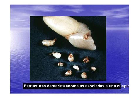 Clase tumores odontog_nicos_ii 9 8 2012