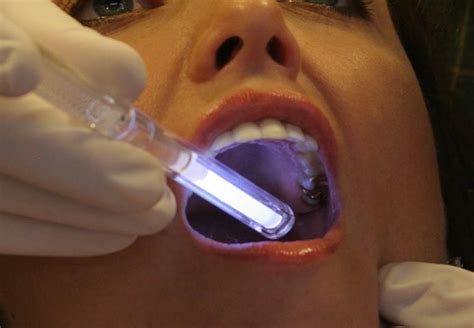Clínica dental Proa   Consejos