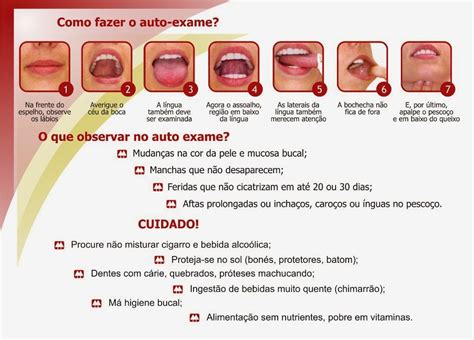 Clinica Dentaria Mais Sorriso: Câncer bucal: sintomas ...