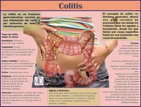 Colitis: Inflamación del intestino grueso o colon – Venelogía