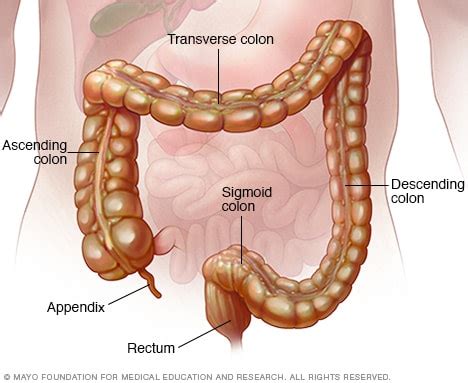 Colitis seudomembranosa   Síntomas y causas   Mayo Clinic