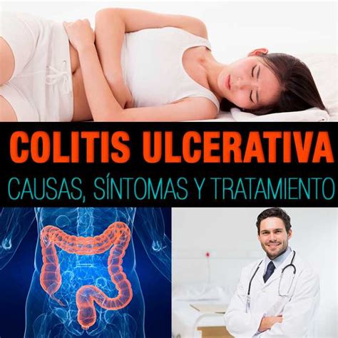 Colitis ulcerativa: causas, síntomas y tratamiento | La Guía de las ...