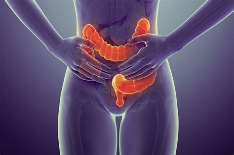 Colon Cancer: Signs, Symptoms, and Complications