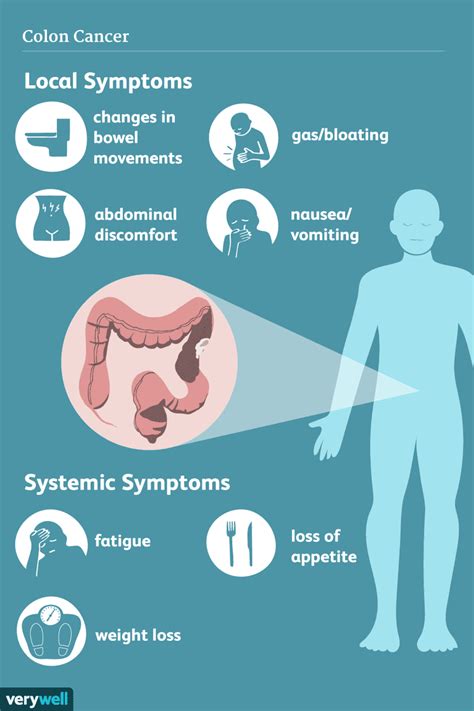 Colon Cancer: Signs, Symptoms, and Complications