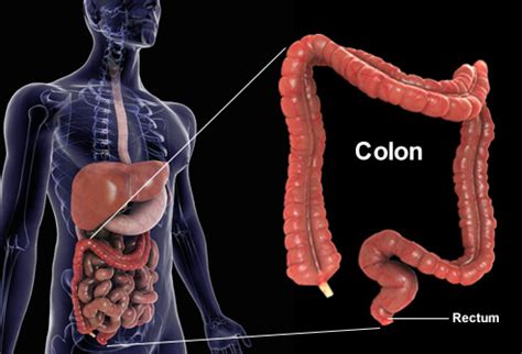 Colorectal Cancer Screening Tests, Stages, Symptoms ...