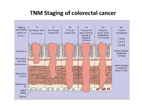 Colorectal MCQs TNM Staging of colorectal cancer yp