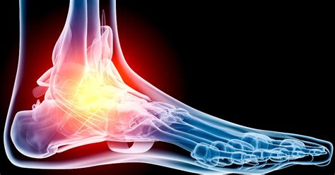 Common Running Injuries: Foot Pain