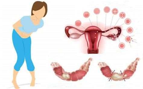 Como Acabar com a Cólica Menstrual de Forma Rápida | Dicas de Saúde