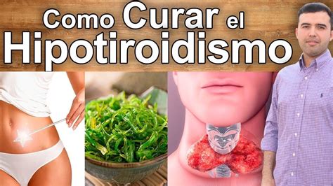 Como Curar El Hipotiroidismo Naturalmente   Alimentos ...