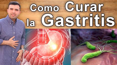 Como Curar La Gastritis   Elimina Tu Gastritis De Manera Rápida Y Natural