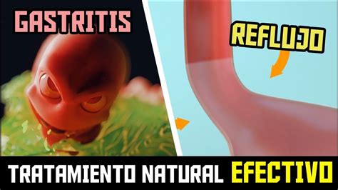 Como CURAR la GASTRITIS y el REFLUJO de forma NATURAL   YouTube