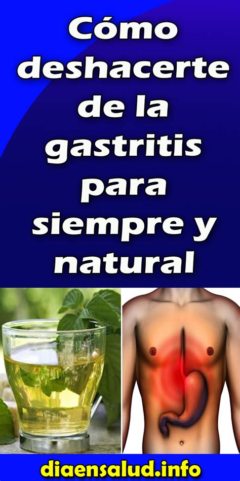 Cómo deshacerte de la gastritis para siempre y naturalmente | Remedios ...