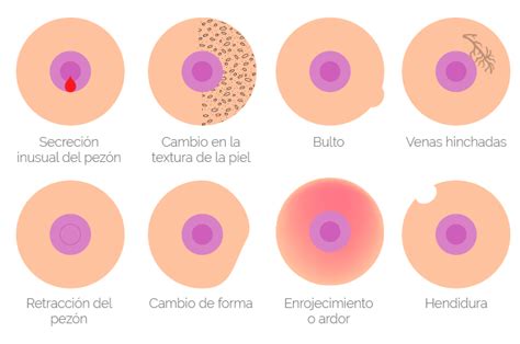 ¿Cómo detectar a tiempo el cáncer de mama?   El País de ...