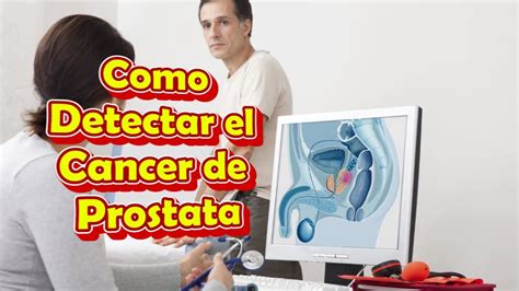 Como Detectar el Cancer de Prostata a Tiempo, Sintomas y ...