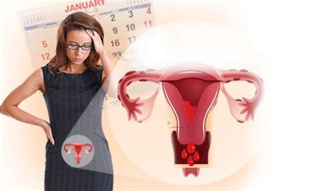 Cómo detener la menstruación tempranamente o hacerla menos abundante ...
