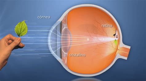 ¿Cómo funciona el ojo humano?   Clínica Rementería