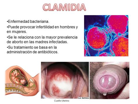 Como Se Contagia La Clamidiasis | Healthy HesongBai